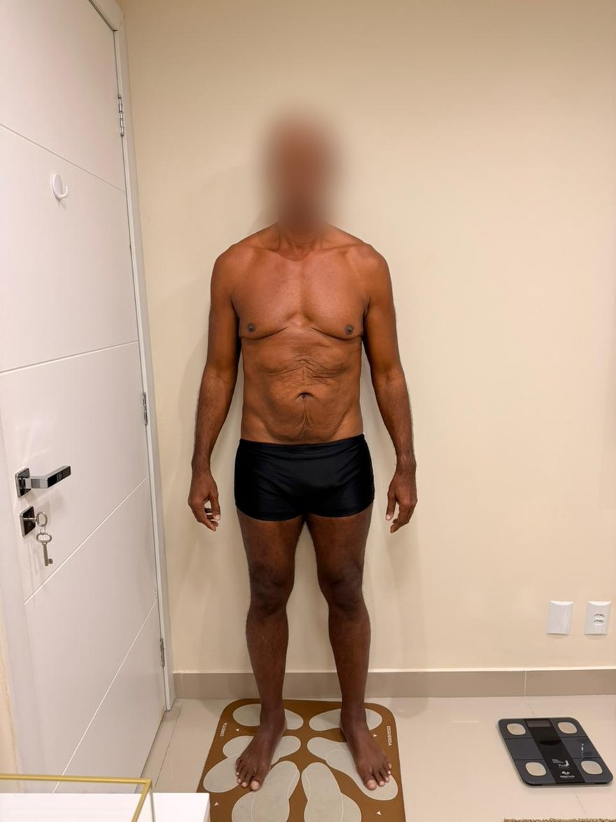 Depois: Evolução corporal de paciente em acompanhamento nutricional, vista frontal