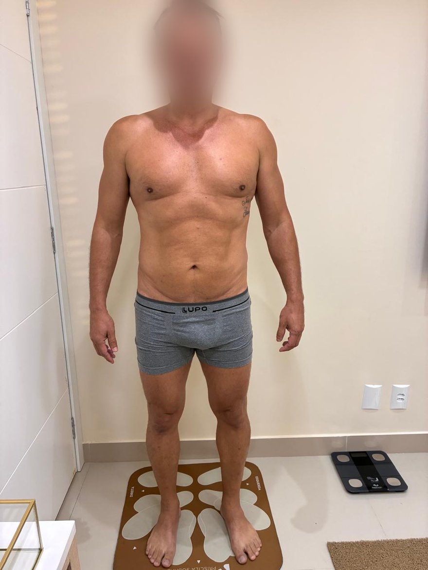 Depois: Evolução corporal de paciente em acompanhamento nutricional, vista frontal