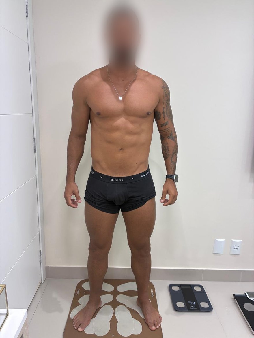 Depois: Evolução corporal de paciente em acompanhamento nutricional, vista frontal